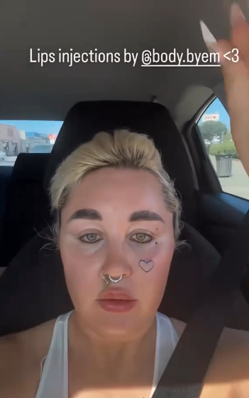 Amanda Bynes showing her lips in a car from a video posted on August 23, 2025 | Source: TikTok/ amanda.bynes1986