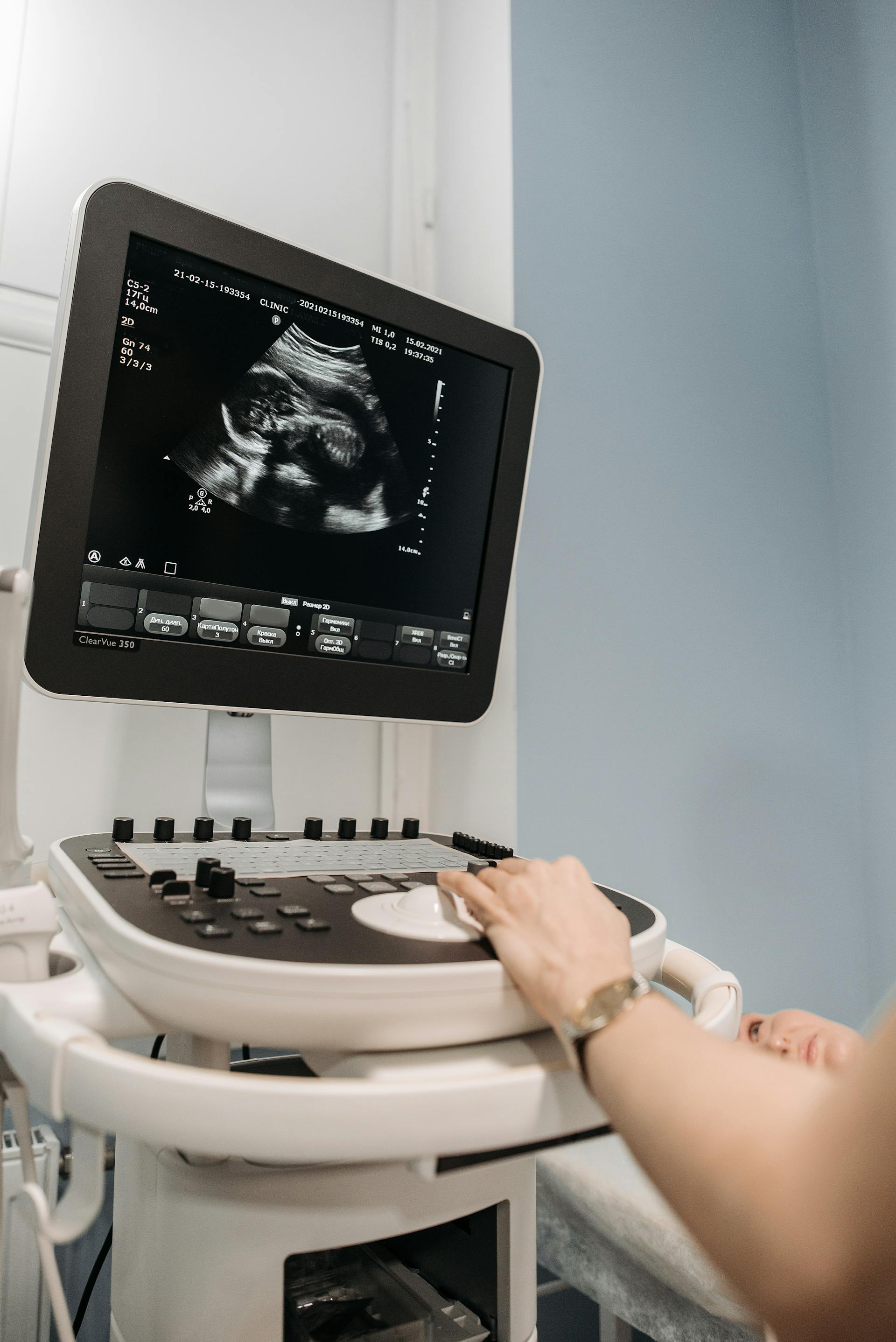 A screen showing an ultrasound scan | Source: Pexels
