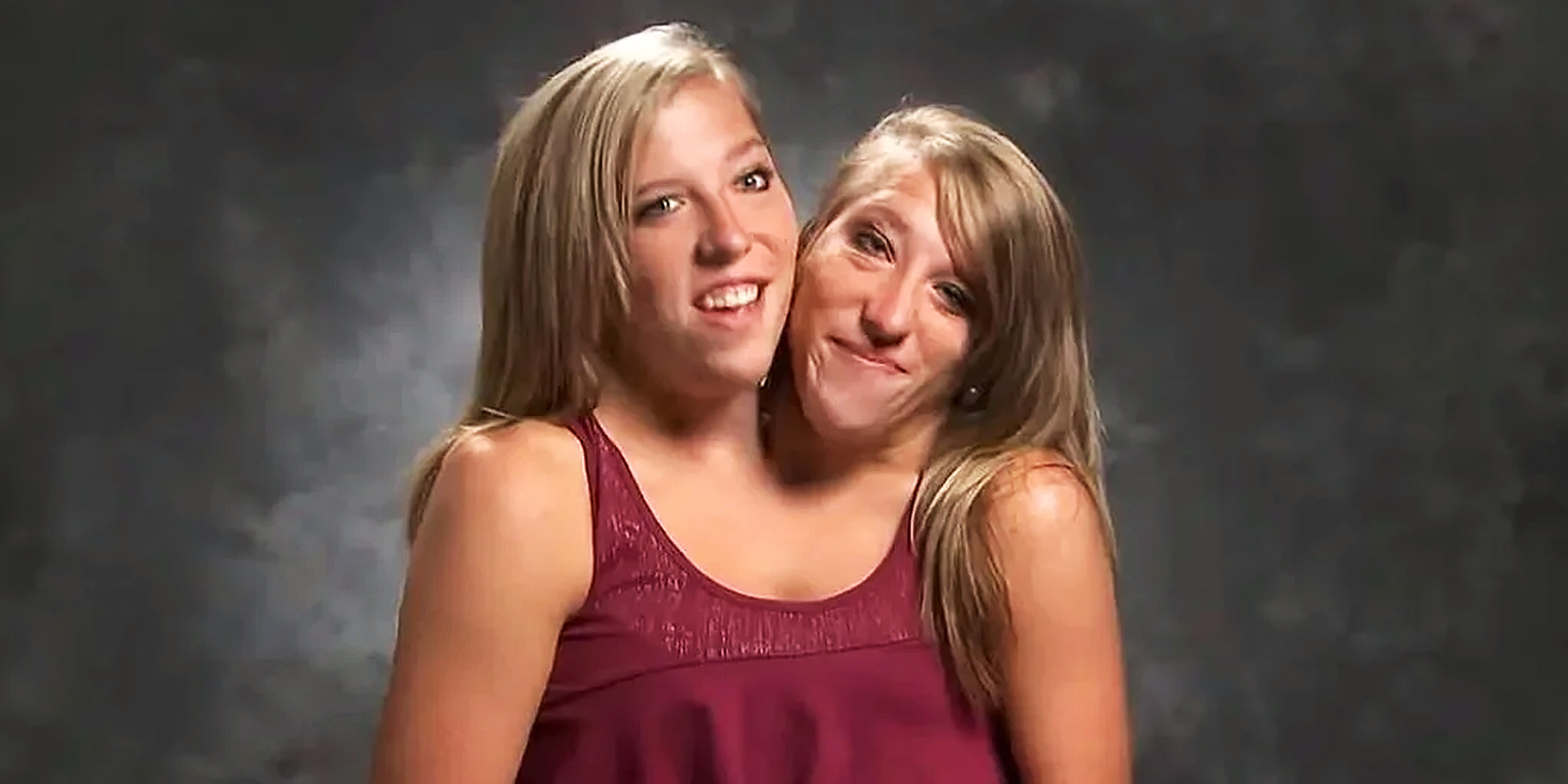 Abby and Brittany Hensel | Source: TikTok/abbyandbrittanyhensel