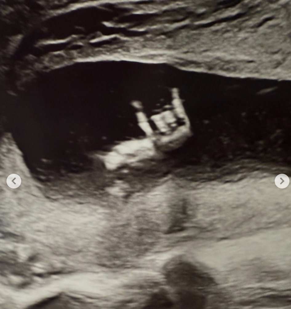 A copy of a sonogram, posted on May 14, 2026. | Source: Instagram/realbarbarapalvin