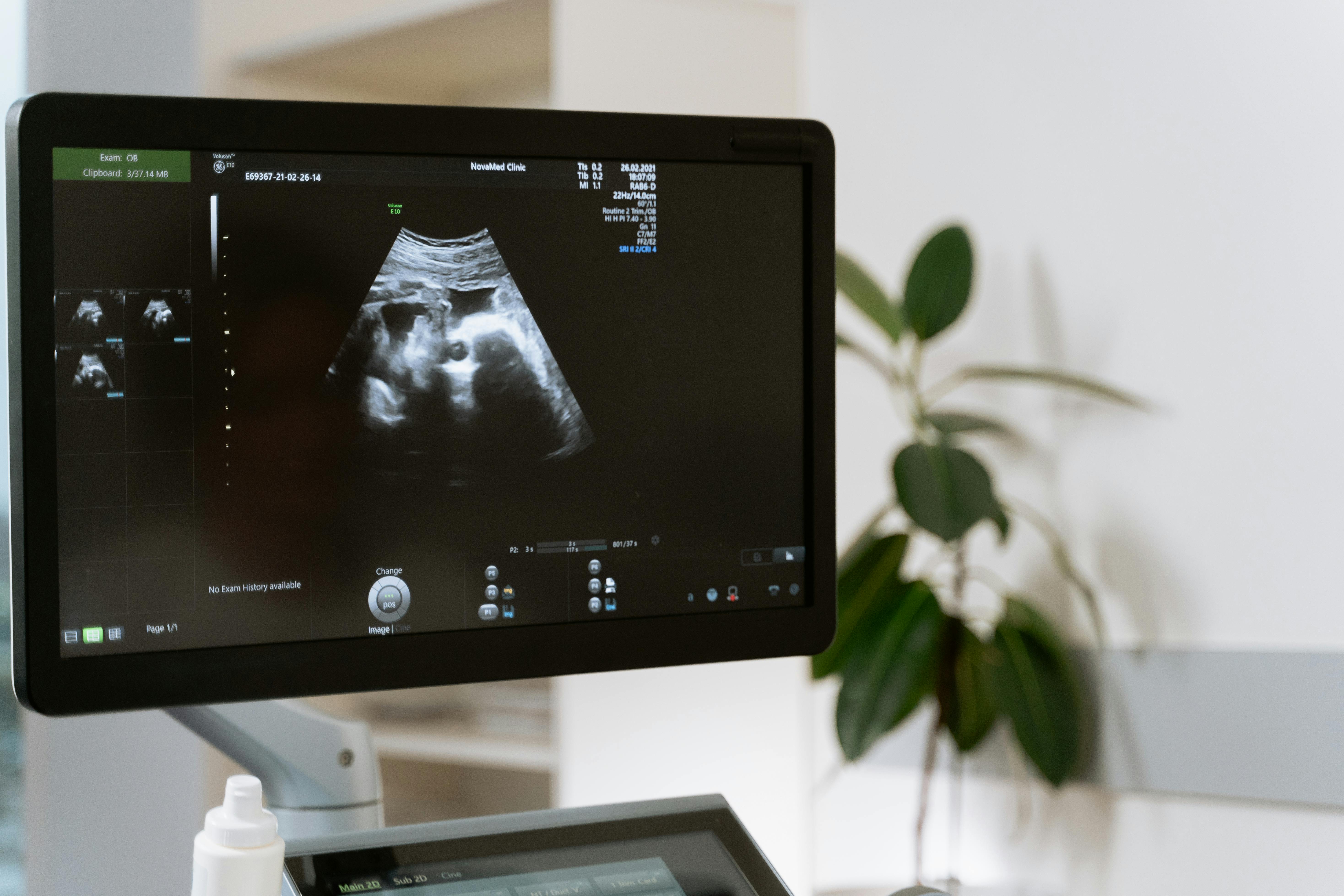 An ultrasound | Source: Pexels